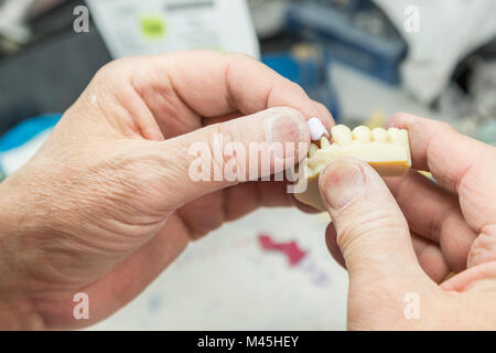 Homme technicien dentaire travaille sur un 3D Printed Moule Pour Tooth implants dans le laboratoire. Banque D'Images