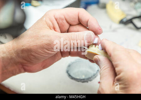 Homme technicien dentaire travaille sur un 3D Printed Moule Pour Tooth implants dans le laboratoire. Banque D'Images