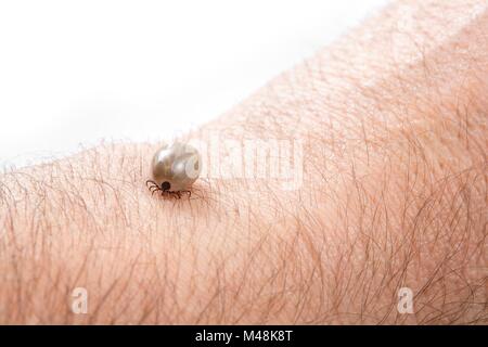 Détail tick - parasite sur le cuir de l'homme (Rhipicephalus sanguineus) Banque D'Images