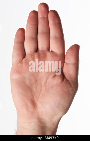 Une part de Palm avec les callosités travailleur isolé sur fond blanc Banque D'Images