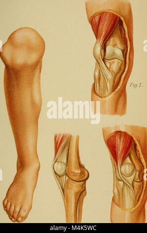Atlas et exemple même de fractures et luxations traumatiques (1902) (14757521726) Banque D'Images