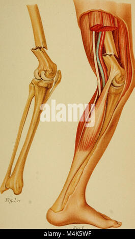 Atlas et exemple même de fractures et luxations traumatiques (1902) (14778144094) Banque D'Images