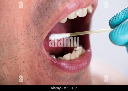 Close-up de dentiste part faire de test de salive sur la bouche avec du coton-tige Banque D'Images