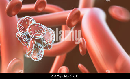 Libre de thrombose- 3D Rendering Banque D'Images