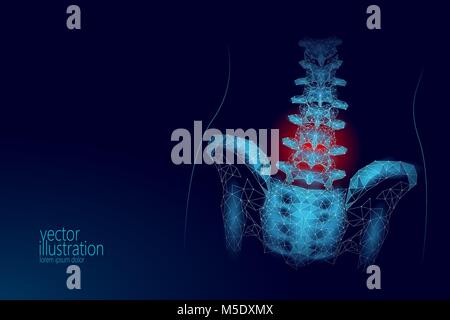 Les droits de la colonne vertébrale lombaire douleur hanche radiculite basse poly. Triangle particules polygonales géométrique point line Technologie de médecine future bleu rouge région douloureuse vector illustration Illustration de Vecteur