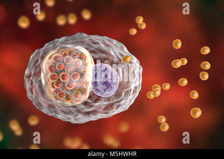 La bactérie Chlamydia psittaci. Illustration d'ordinateur montrant deux stades de vie de la Chlamydiose : corps élémentaires (non-extracellulaire multipliant le stade infectieux, les petites sphères orange à l'extérieur de la cellule) et l'inclusion d'un composé d'un groupe de corps réticulés chlamydia intracellulaires (stade, multipliant les petites sphères orange à l'intérieur de la CDDE) près du noyau (violette) d'une cellule. Les espèces de Chlamydia sont des bactéries atypiques en ce qu'ils sont des parasites intracellulaires obligatoires, vivant et se reproduisant seulement à l'intérieur des cellules. Cette espèce provoque l'avortement chez les animaux et les maladies respiratoires chez les humains. Banque D'Images