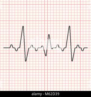 Illustration sur la ligne noire cardiogramme médical grille rouge Illustration de Vecteur