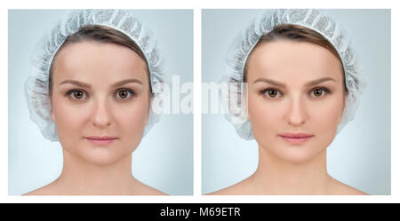 Portrait de visage de femme, avant et après la chirurgie plastique. Traitement anti-vieillissement et l'ascenseur de visage. Banque D'Images