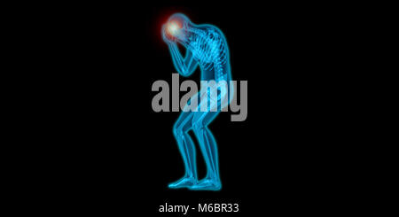 Illustration d'un homme souffrant de migraines Banque D'Images