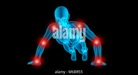 Translucide très détaillée des corps d'un homme faisant un push up et avoir de la douleur dans ses articulations Banque D'Images