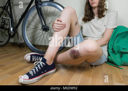 Personne de sexe féminin est assis sur le plancher à la maison et regarde jambe blessée après une chute au cours de son vélo Le vélo ou la navette Banque D'Images