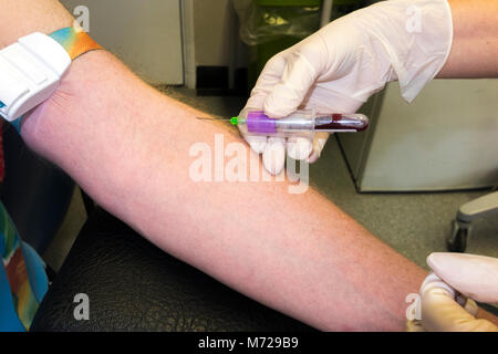 Test sanguin effectué sur le bras d'un homme d'âge moyen / sang prélevé pour examen par une infirmière de pratique à un médecin / médecin chirurgie. ROYAUME-UNI (95) Banque D'Images