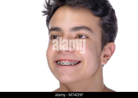 Cute adolescent avec fond blanc, portant des bagues sur les dents. Banque D'Images
