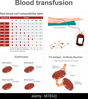 Il y a deux types de sang spécial quand il s'agit de transfusions de sang. Vecteur graphique d'information. Illustration de Vecteur