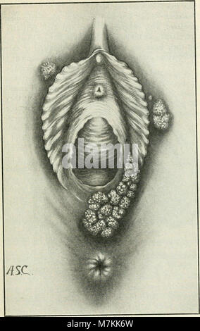 Un manuel de gynaecology et chirurgie pelvienne, pour les étudiants et les praticiens (1916) (14581183677) Banque D'Images