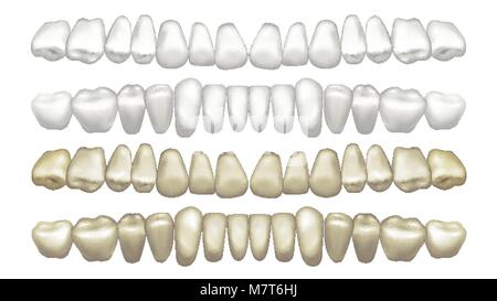 Vecteur de blanchiment des dents. Avant et après. Blanchiment des dents fines. Illustration isolé Illustration de Vecteur