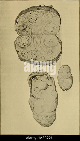 Des conférences sur la clinique de sténose de l'urètre et de l'élargissement de la prostate (1901) (14597705538) Banque D'Images