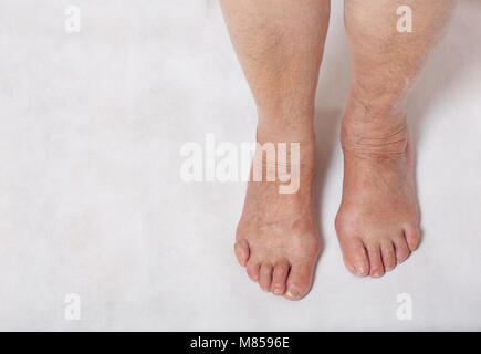 Pieds d'un senior femme entre 70 et 80 ans Banque D'Images