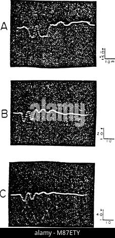 Cette étude de 1980 étudie les effets d'un bruit acoustique intense sur la fonction cochléaire chez le cobaye, en examinant l'impact de l'exposition au bruit sur l'audition chez les nourrissons et les adultes. Banque D'Images