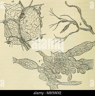 Pathologie chirurgicale générale et de thérapeutique, en cinquante-et-une lectures (1879) (14747911336) Banque D'Images