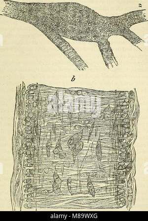 Pathologie chirurgicale générale et de thérapeutique, en cinquante-et-une lectures (1879) (14790786243) Banque D'Images