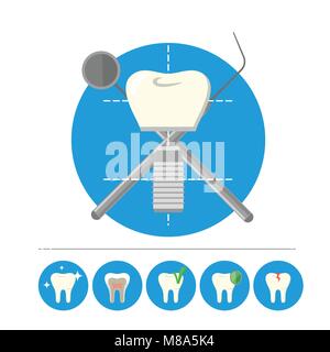 Implant dentaire, vector isolés Illustration de Vecteur