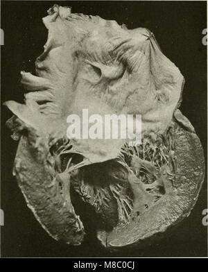 Cette publication de 1920 explore les maladies qui affectent la poitrine, y compris les affections respiratoires, et discute des principes du diagnostic physique utilisés par les professionnels de la santé pour identifier de telles maladies. Banque D'Images