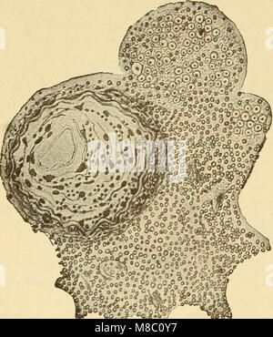 Cette publication de 1910 explore diverses maladies affectant le système nerveux, y compris les troubles neurologiques, leurs symptômes et les options de traitement disponibles à l'époque. Le texte fournit un aperçu de la compréhension médicale précoce de la neurologie et des défis dans le diagnostic et le traitement des affections du système nerveux. Banque D'Images