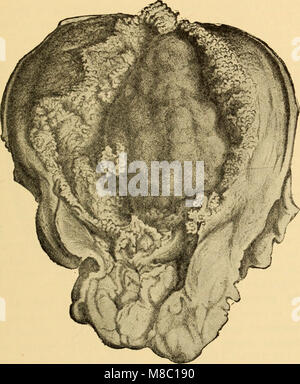 Les maladies des femmes. Un guide clinique pour le diagnostic et le traitement (1899) (14765924424) Banque D'Images