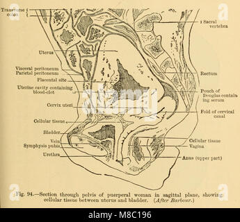 Les maladies des femmes. Un guide clinique pour le diagnostic et le traitement (1899) (14767927122) Banque D'Images