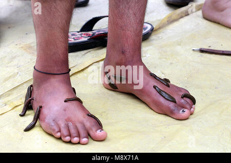 Srinagar, Jammu-et-Cachemire, . Mar 21, 2018. Un homme reçoit du Cachemire leech thérapie sur le Norouz, qui marque le premier jour du printemps et le début de l'année dans le calendrier Persan à Srinagar, au Cachemire le 21 mars 2018 les travailleurs de la santé traditionnelles au Cachemire utiliser les sangsues pour traiter les personnes souffrant de différentes maladies de peau. Credit : Faisal Khan/ZUMA/Alamy Fil Live News Crédit : ZUMA Press, Inc./Alamy Live News Banque D'Images