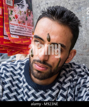 Srinagar, Jammu-et-Cachemire, en Inde. Mar 21, 2018. Leachs suce le sang de la face d'un homme à Srinagar.Le jour de Norouz ( début de l'année au calendrier persan) des centaines de patients atteints de différentes maladies liées à la peau viennent recevoir la thérapie de la sangsue. Le jour de Norouz leech le traitement est jugé plus efficace. Les gens de différents groupes d'âge se rassemblent à la périphérie d'Hazratbal Srinagar, Cachemire indien à recevoir la thérapie de la sangsue. Credit : Masrat Zahra/SOPA Images/ZUMA/Alamy Fil Live News Banque D'Images