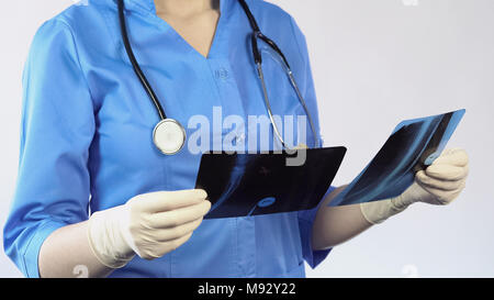 Chirurgien traumatologie holding patient x-ray suite faire le diagnostic, le traitement d'hôpital Banque D'Images