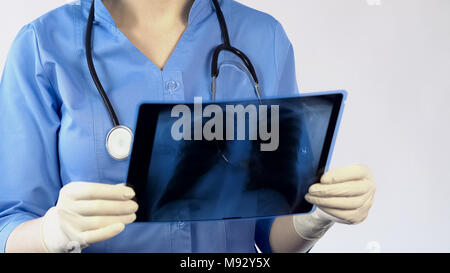 Thérapeute à la recherche sur les poumons x-ray et poser un diagnostic, traitement des patients Banque D'Images