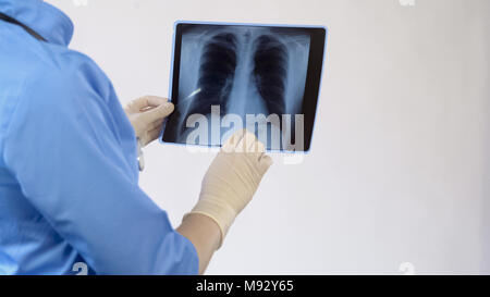 Médecin patient contrôle rx poumons, le traitement des maladies des bronches, la pneumonie Banque D'Images
