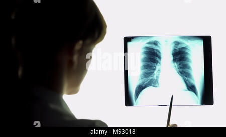 L'analyse de thérapeute la pneumonie poumons radiographie de faire des conclusions, des soins de santé Banque D'Images