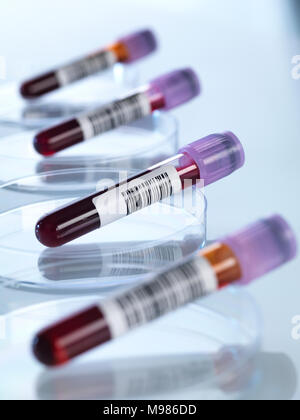Des échantillons de sang dans des boîtes de Petri Banque D'Images