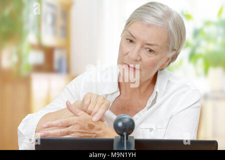 Senior woman devant un écran d'ordinateur avec un appareil photo connecté montrant son médecin une taupe sur sa main pendant l'appel vidéo, le concept de télémédecine Banque D'Images