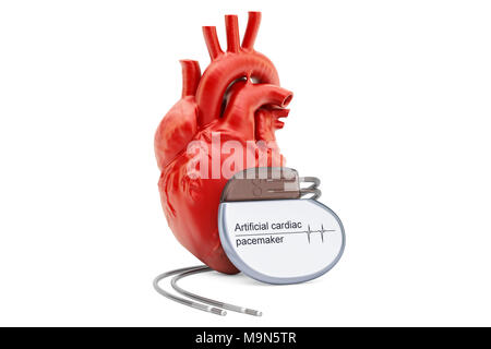 Stimulateur cardiaque artificiel avec coeur humain, rendu 3D isolé sur fond blanc Banque D'Images