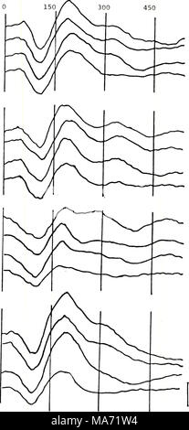 . Effets du traitement phonétique et sur la pertinence de stimulation de la réponse évoquée auditive. . La figure 8. Potentiels évoqués en moyenne de 5 à 8 Sujets enregistrés durant les conditions de pertinence de stimulation. Calibrage  = 10 microvolts. Banque D'Images