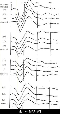 . Effets du traitement phonétique et sur la pertinence de stimulation de la réponse évoquée auditive. . La figure 7. Potentiels évoqués en moyenne de 1 à 4 Sujets enregistrés durant les conditions de pertinence de stimulation. Calibrage  = 10 microvolts. Banque D'Images