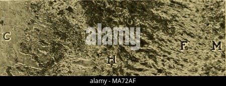 . Les effets de l'inanition et de la malnutrition sur la croissance et la structure . Banque D'Images