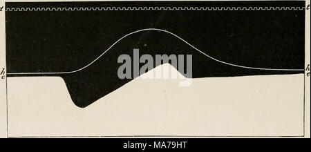 . L'électro-physiologie . Kni. 131.-courbe de contraction (h) et l'action actuelle (c) de la grenouille coeur battant spontanément. (A. D. Waller.) également analogue à celle de la grenouille. Avec l'excitation artificielle de l'excisée et repos, le ventricule déjà électrode proximale est à d'abord négatif, positif et immédiatement après, à l'électrode distale, et une variation diphasique est ainsi produite, en conséquence des deux courants d'action phasique, semblable en tous points à celui de la grenouille. En raison, toutefois, de l'excitation de la vitesse beaucoup plus grande dans le coeur de sang chaud - un Banque D'Images