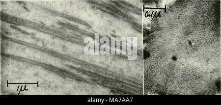 . La microscopie électronique ; actes de la Conférence de Stockholm, septembre 1956 . Fig. 3. Des électrons Microphotographie montrant des fibrilles de kératine qui apparaissent dans une cellule corticale dans la haute région de l'ampoule (coupe longitudinale). 20,000 d'agrandissement. Fig. 4. Une section à fort agrandissement d'un montrant le composant fibrillaire filaments de kératine (lumière) sur un sol foncé-L-cystine matrice riche. 150 000 Grossissement. sans aucune preuve d'un précurseur non fibreux. Filaments artificiels peuvent être détectés au microscope électronique dans les cellules de l'ampoule à un niveau en dessous de laquelle le bire- fringence est assez forte pour être demonstr Banque D'Images