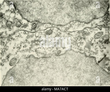 . La microscopie électronique ; actes de la Conférence de Stockholm, septembre 1956 . Fig. 1. Un ultra fin section d'une culture de tissu de rein de singe wiiich avait été infecté par les virus. Le tissu est fixé 48 heures après l'infection. Sur la photo les noyaux des deux cellules sont à voir qui montrent clairement la double membrane. En outre, la frontière de la cellule est facilement reconnaissable comme une double membrane. Dans le protoplasma mitochondries divers avec leurs cloisons. Dans le hyaloplasma il y avait beaucoup de petites formes, rond ; en outre, il y avait quelques zones osmiophiles hyalin. Siemens Electro Banque D'Images
