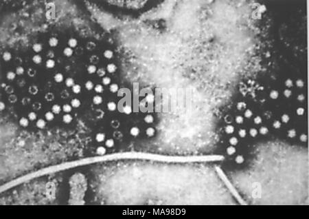L'hépatite E (VHE) membre de la famille des Caliciviridae, révélé dans les électrons Microphotographie film, 2004. Image courtoisie Centres for Disease Control (CDC). () Banque D'Images