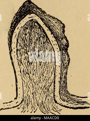 . Entomologie économique . Volvulifex aceris produit par Phytoptus, Section de culot d'Volvulife) aceris. le sycomore (acer pseudoplatanus, var. Leopold !), le contraste de la tête lumineuse avec les galles de la feuille jaune pâle est très belle et attrayante. Le Phytopti qu'on retrouve dans ces galles sont blanc jaunâtre. Phytoptus myriadeum Cephaloneon myriadeum (, Bremi).-24. Spécimen de feuilles de plane recouverte de ces galles ; 26. Croquis de l'idem. Ces ont généralement été considérée comme étant la même que la précédente sur l'écorchure sycamore ; mais nous avons peu de doute que c'est la spec Bremi Banque D'Images