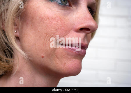 Femme avec le vieillissement de la peau Banque D'Images