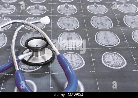 Vue en perspective d'une IRM du cerveau humain (transversales) et d'un blue stethoscope Banque D'Images