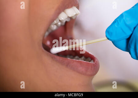 Close-up of a Dentist's part faire de test de salive sur la bouche avec du coton-tige Banque D'Images